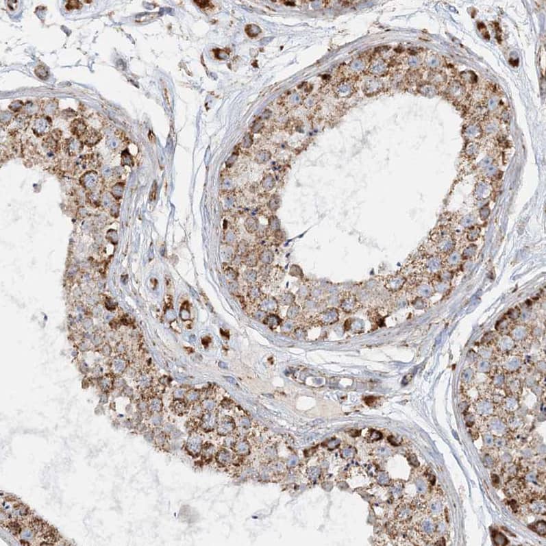 Immunohistochemistry-Paraffin CCDC56 Antibody - BSA Free