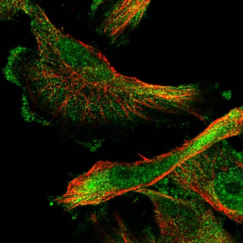 Staining of human cell line U-251 MG shows localization to nucleoplasm & plasma membrane.