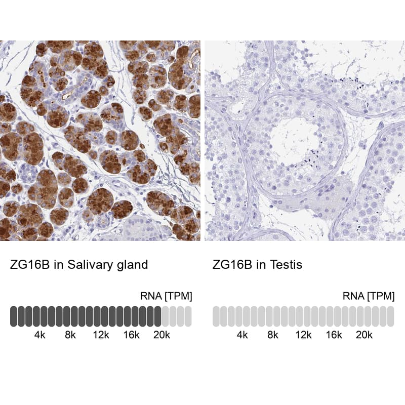 <b>Orthogonal Strategies Validation. </b>Analysis in human salivary gland and testis tissues. Corresponding RNA-seq data are presented for the same tissues.