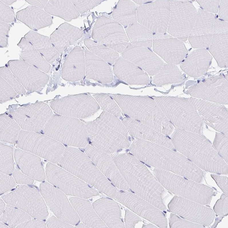 Staining of human skeletal muscle shows no positivity in myocytes as expected.