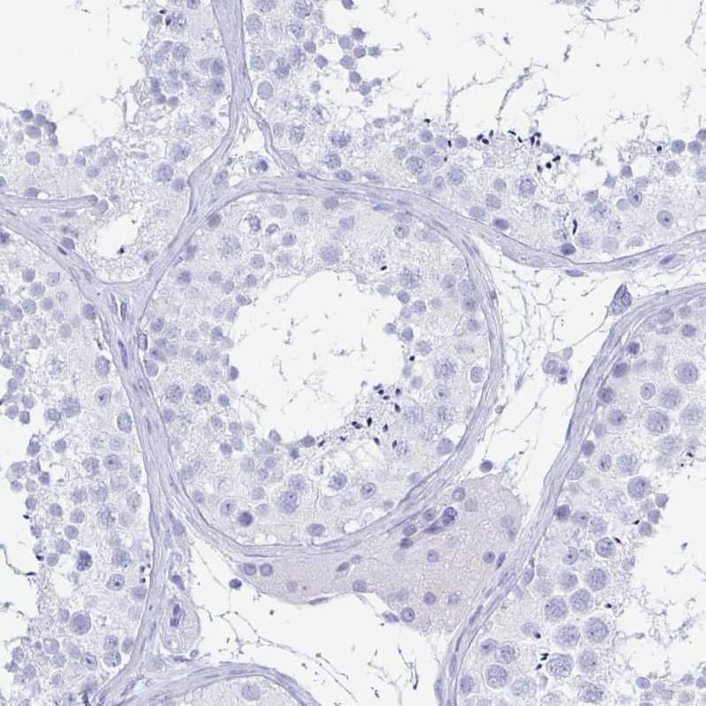 Staining of human testis shows no positivity in cells in seminiferous ducts as expected.