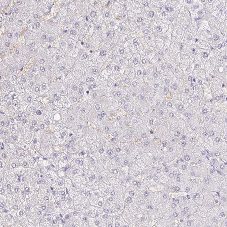 Staining of human liver shows no positivity in hepatocytes as expected.