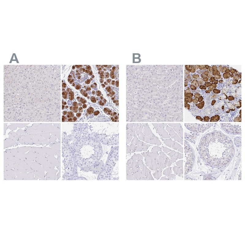 <b>Orthogonal Strategies Validation. </b>Staining of human liver, salivary gland, skeletal muscle and testis HPA041125 (A) shows similar protein distribution across tissues to independent antibody HPA053549 (B).