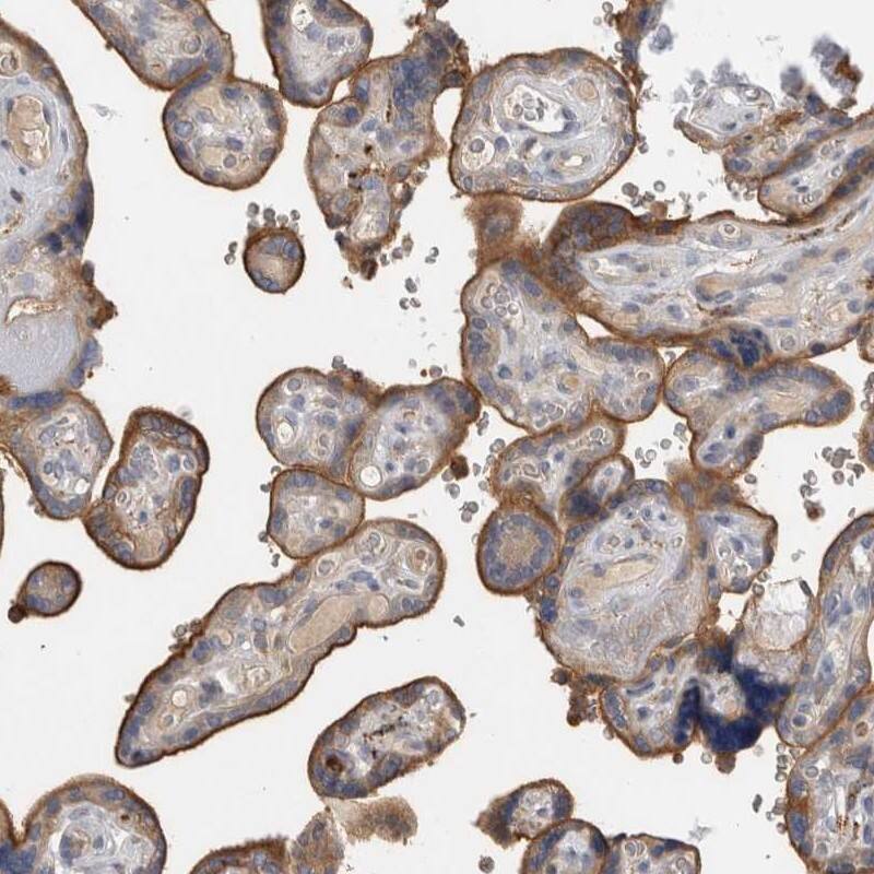 Staining of human placenta shows cytoplasmic and membranous positivity in trophoblastic cells.