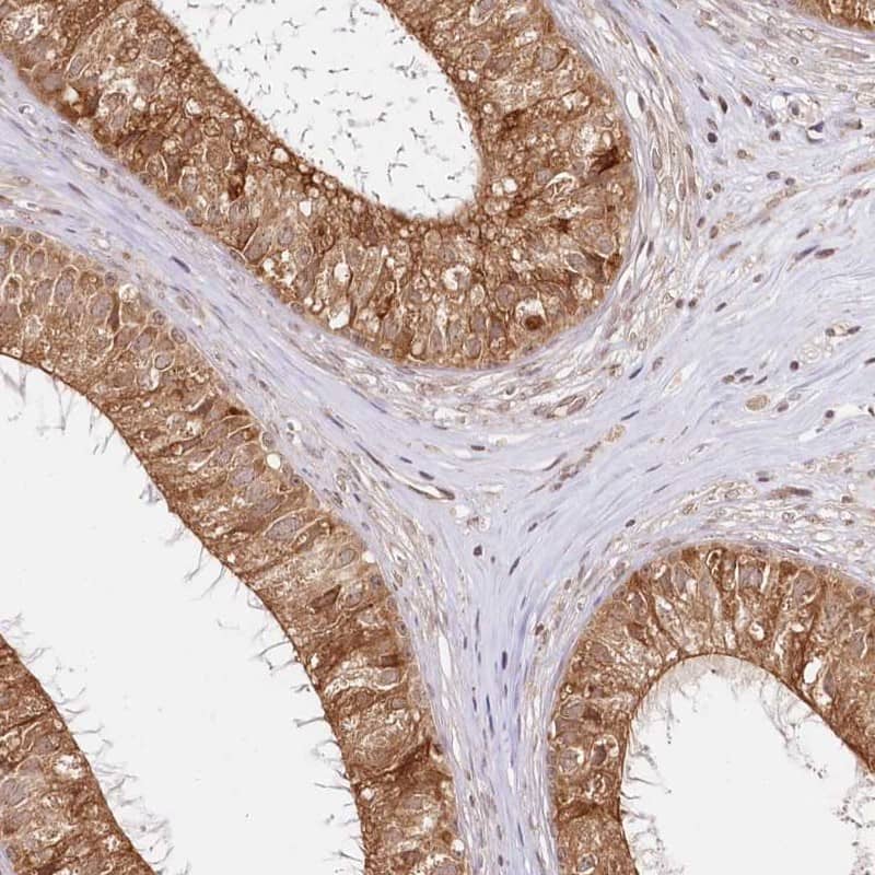 Staining of human epididymis shows cytoplasmic positivity in glandular cells.