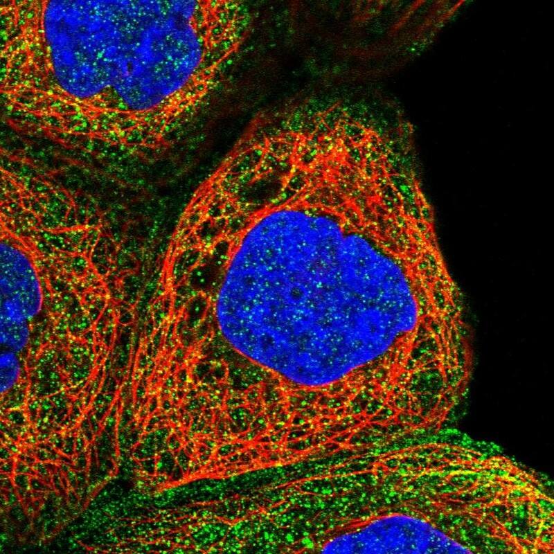 Staining of human cell line A-431 shows localization to plasma membrane & cytosol.