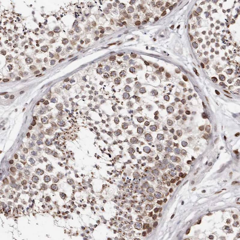 Staining of human testis shows moderate positivity in nuclear membrane in cells in seminiferous ducts.