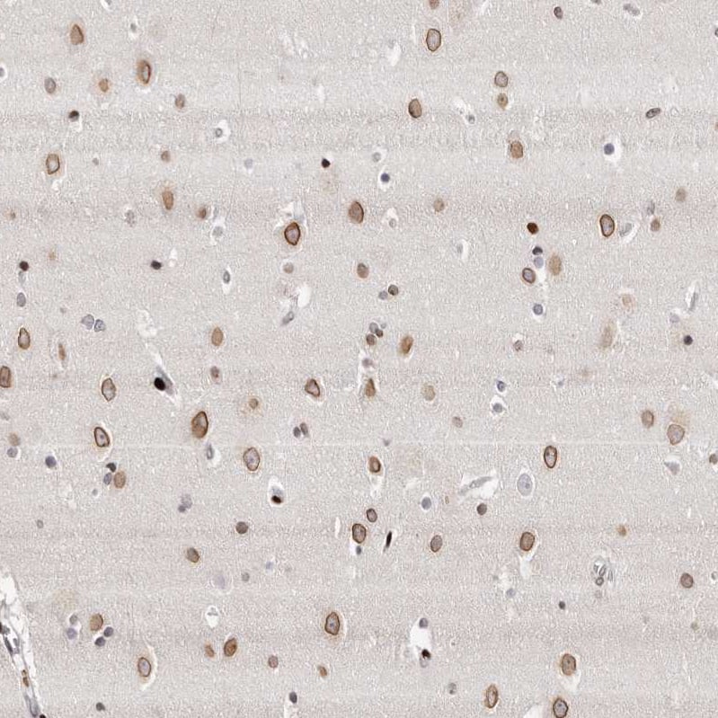 Staining of human cerebral cortex shows moderate to strong positivity in nuclear membrane in neurons.