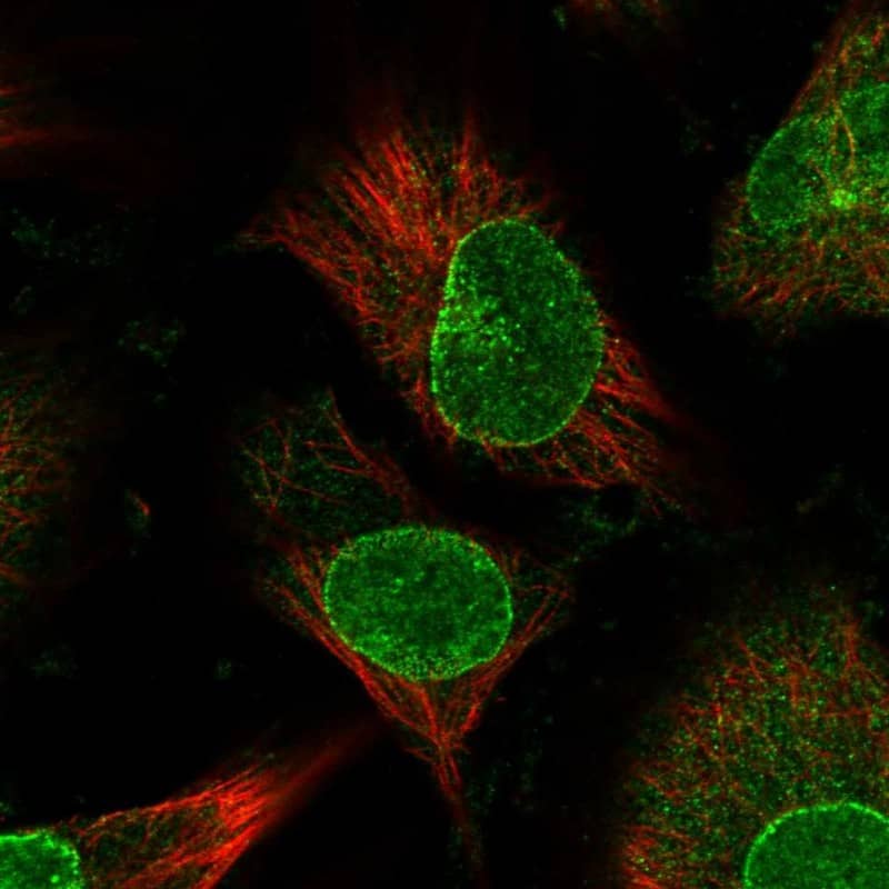 Staining of human cell line U-251 MG shows localization to nuclear membrane.