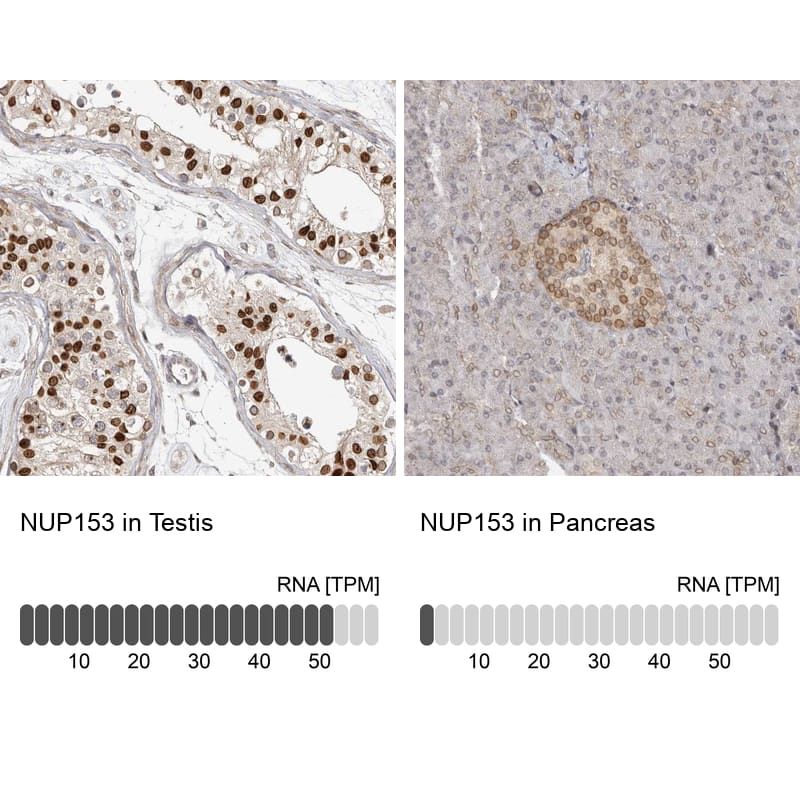 <b>Orthogonal Strategies Validation. </b>Analysis in human testis and pancreas tissues. Corresponding RNA-seq data are presented for the same tissues.