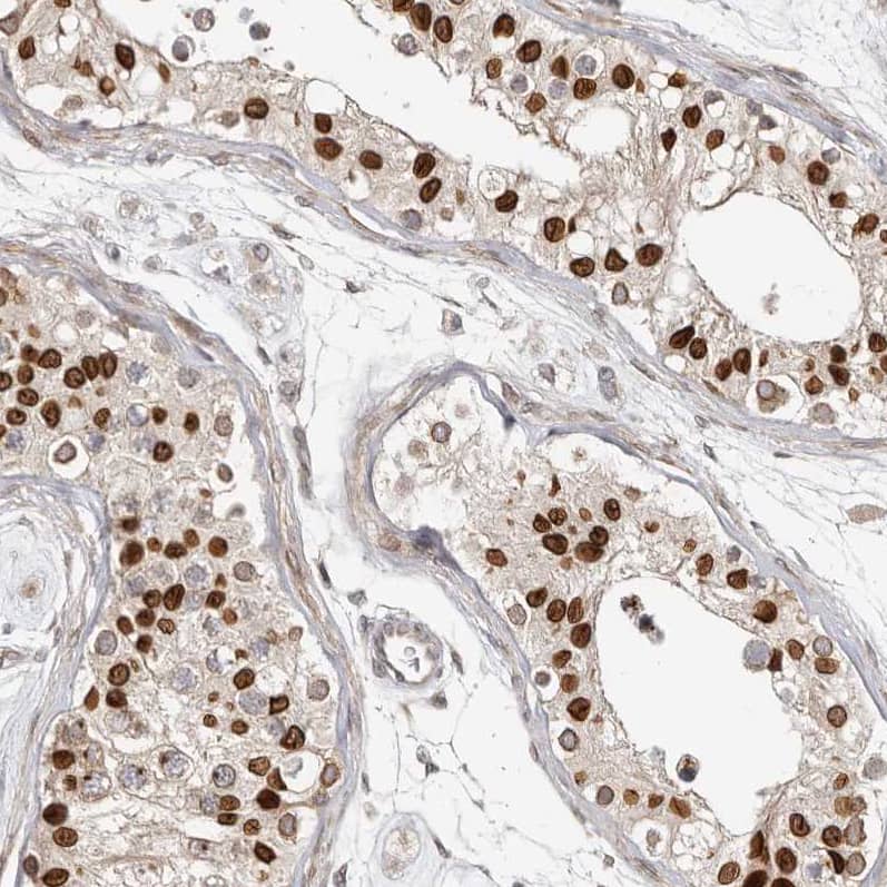Staining of human testis shows strong positivity in nuclear membrane in cells in seminiferous ducts.