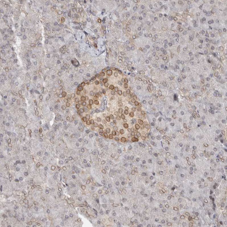 Staining of human pancreas shows weak  positivity in nuclear membrane in islets of Langerhans.