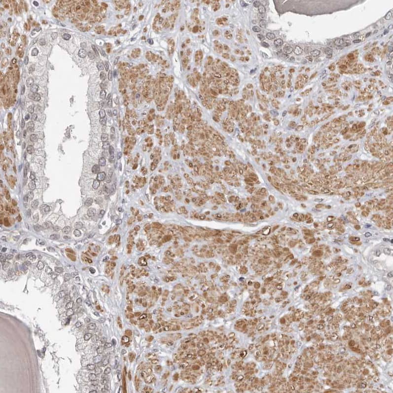 Staining of human prostate shows moderate positivity in nuclear membrane and cytoplasm in smooth muscle cells.