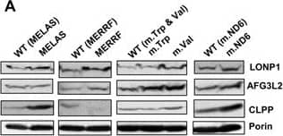 Western Blot: LONP1 Antibody [NBP1-81734] - Altered mitochondrial features in cybrid cells carrying MELAS, MERRF, m.5514 A > G (mt-tRNATrp), m.1643A > G (mt-tRNAVal), & m.14487 T > C (ND6) mutations. (A) Representative western blot of LONP1, AFG3L2 & CLPP peptidases in mutant & wild type (WT) cybrid cells. The membrane was also probed with porin as a loading control. Full-length western blots & lower-exposure blots of porin are included in supplementary information. (B) Densitometric analysis of LONP1, AFG3L2 & CLPP normalized to porin & represented as fold change relative to WT (top). Quantitative data are from at least three independent experiments. Results from this analysis are also shown as a heatmap (bottom). The color & the corresponding value in log2 scale are depicted on the left. (C) Representative Blue Native-PAGE of OXPHOS complexes in mutant & WT cybrid cells. Full-length blots & lower-exposure blots for those with high contrast are included in supplementary information. (D) Densitometric analysis of OXPHOS complexes normalized to complex-II (loading control) & represented as fold change relative to WT. (E) Cellular ATP determination in mutant & WT cybrid cells. (F & G) Determination of Ca2+ (F) & ROS (G) by flow cytometry in mutant & WT cybrid cells with Fluo-3 & MitoSOX Red, respectively. All data are the mean ± SEM of at least three different experiments. Differences from WT values were found to be statistically significant at *p < 0.05, **p < 0.01 & ***p < 0.001. Image collected & cropped by CiteAb from the following publication (//pubmed.ncbi.nlm.nih.gov/28740091), licensed under a CC-BY license. Not internally tested by Novus Biologicals.