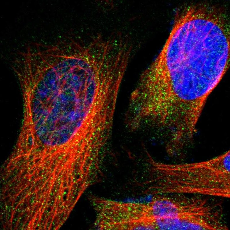 Immunocytochemistry/ Immunofluorescence Glucokinase/GCK Antibody - BSA Free