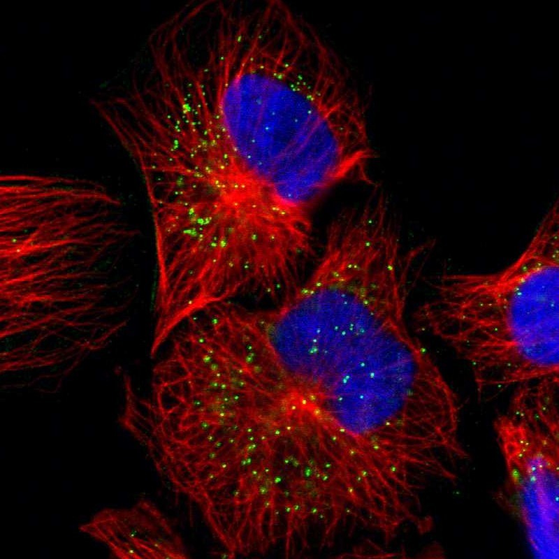 Immunocytochemistry/ Immunofluorescence JTB Antibody - BSA Free