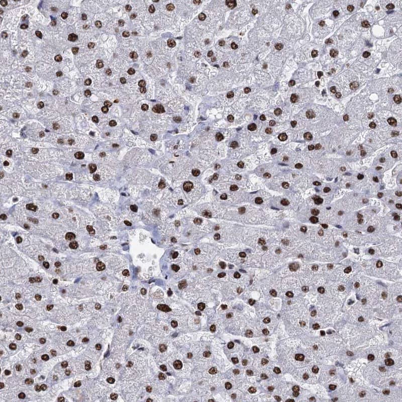 Staining of human liver shows strong nuclear positivity in hepatocytes.
