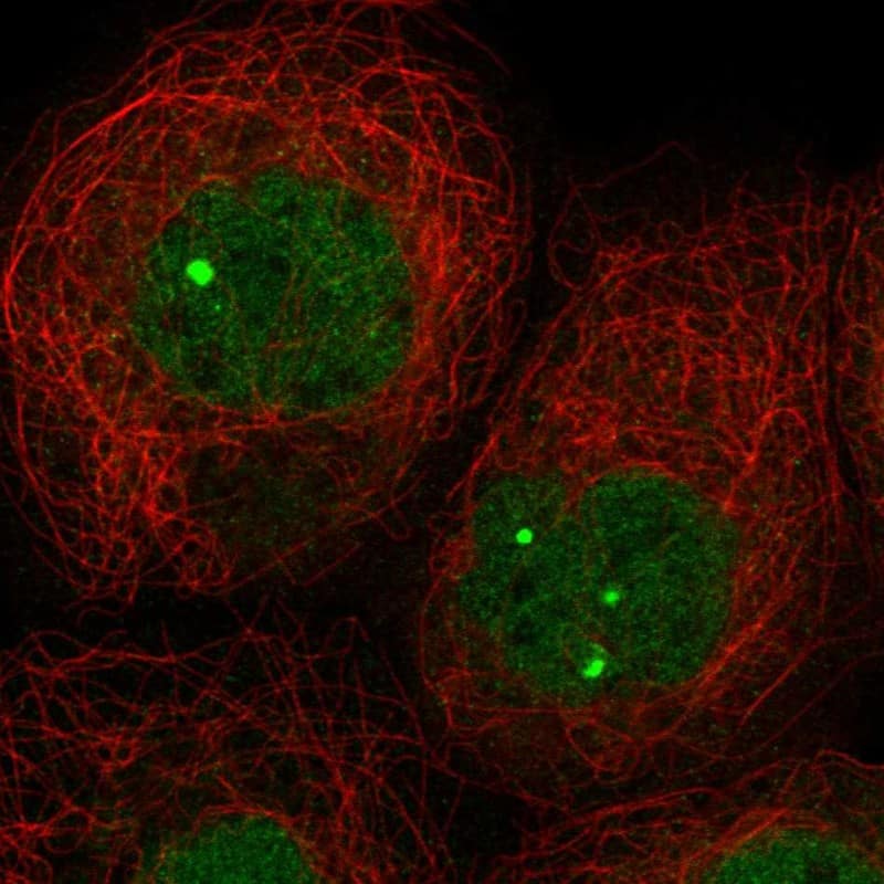 Staining of human cell line A-431 shows localization to nucleoplasm & nuclear bodies.