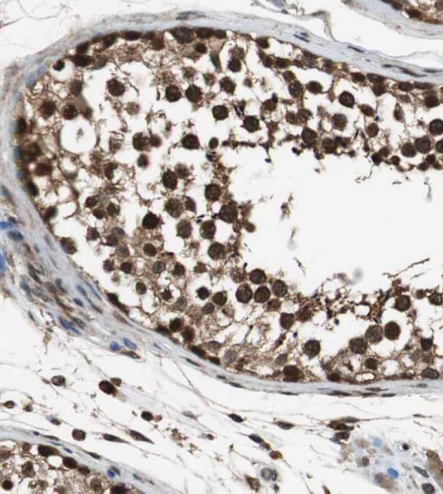  Staining of human testis shows strong cytoplasmic and nuclear positivity in cells in seminiferous ducts.