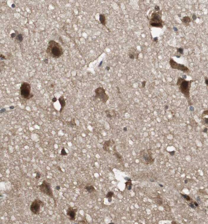  Staining of human cerebral cortex shows strong cytoplasmic-nuclear positivity in neurons.