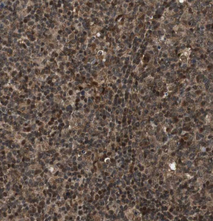  Staining of human lymph node shows strong nuclear positivity in non-germinal center cells and germinal center cells.