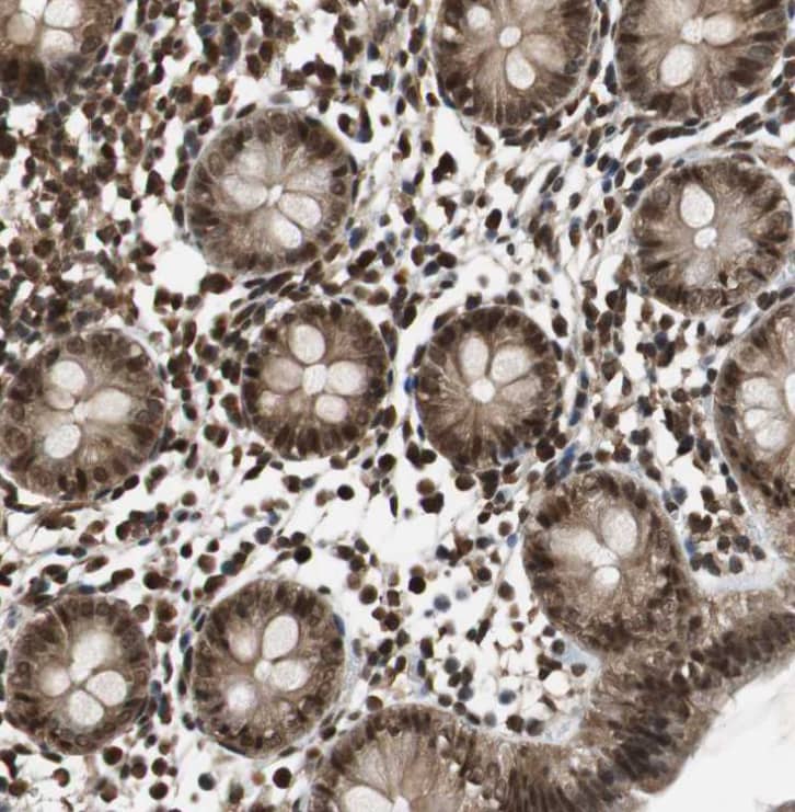  Staining of human colon shows moderate nuclear positivity in glandular cells.