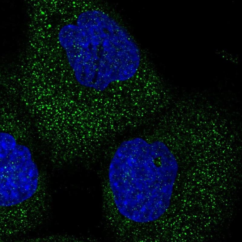 Staining of human cell line A-431 shows localization to cytosol.