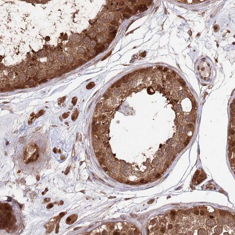 Staining of human testis shows moderate to strong nuclear positivity in cells in seminiferous ducts.