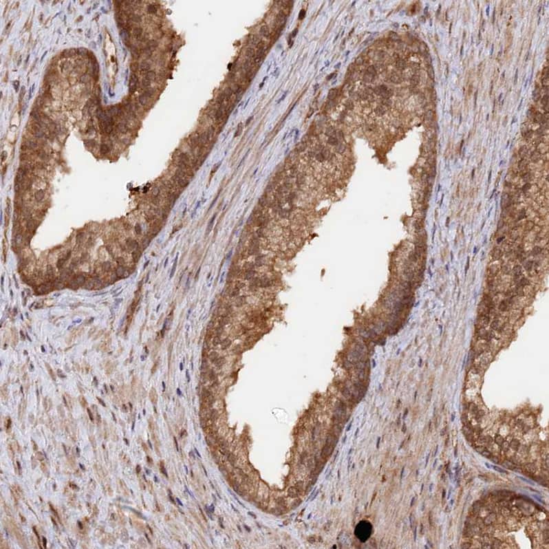Staining of human prostate shows moderate to strong nuclear positivity in glandular cells.