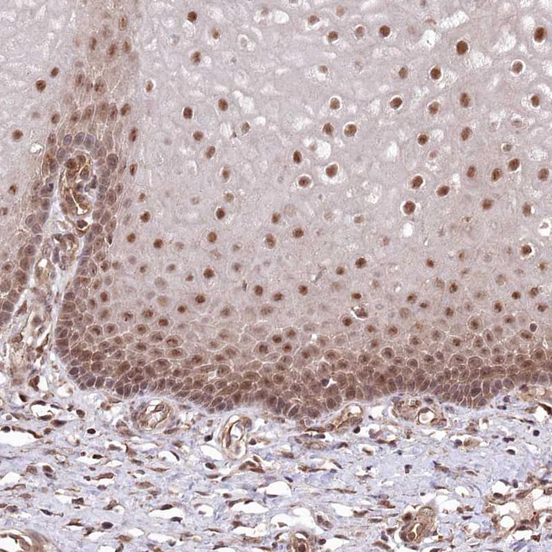 Staining of human cervix, uterine shows moderate to strong nuclear positivity in squamous epithelial cells.