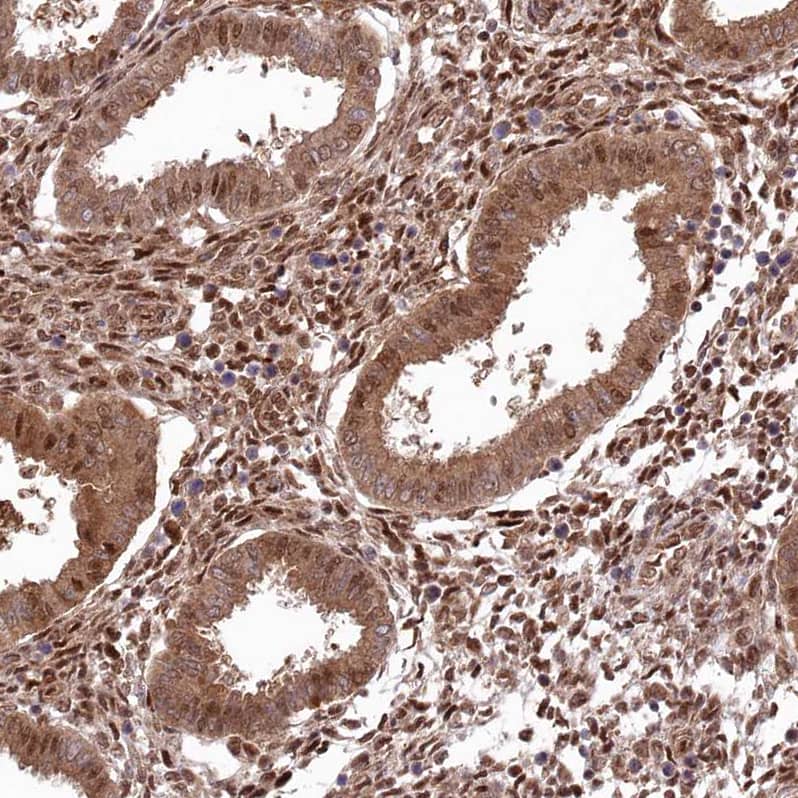 Staining of human endometrium shows moderate to strong nuclear positivity in glandular cells.