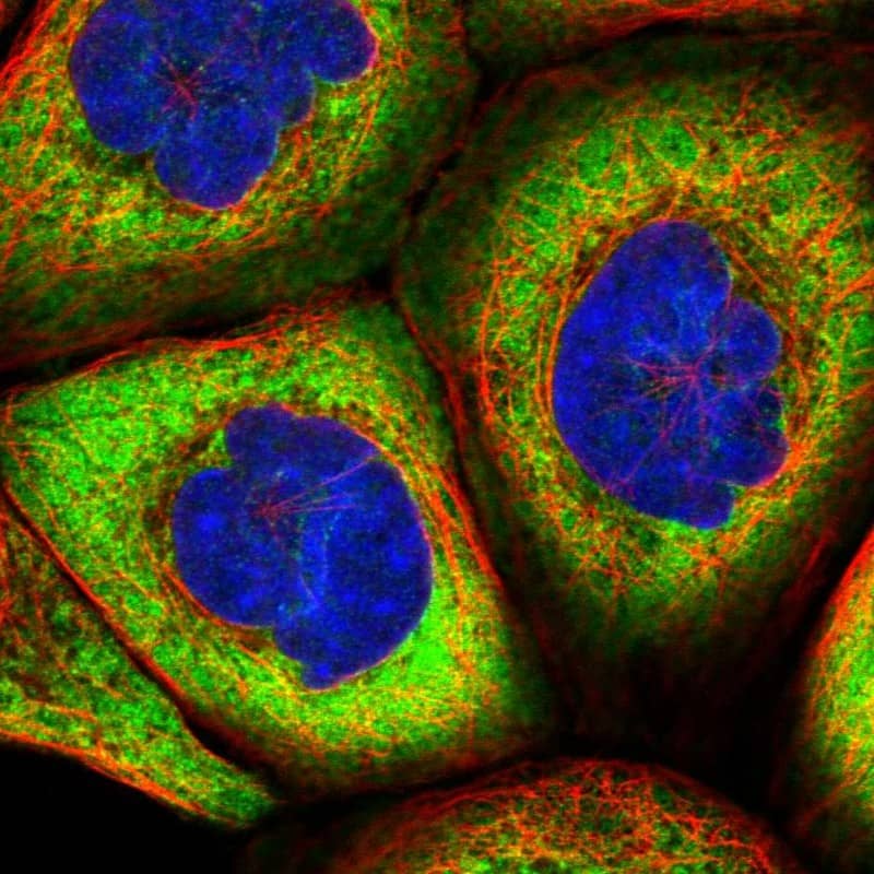 Immunocytochemistry/ Immunofluorescence HARS2 Antibody - BSA Free