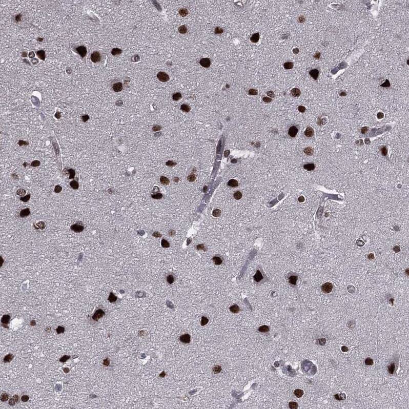 Staining of human cerebral cortex shows strong nuclear positivity in neurons.