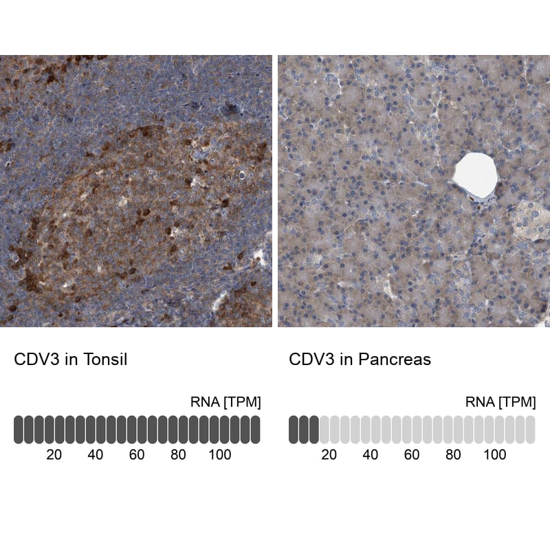 <b>Orthogonal Strategies Validation. </b>Analysis in human tonsil and pancreas tissues.