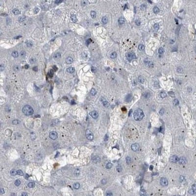 Staining of human liver.
