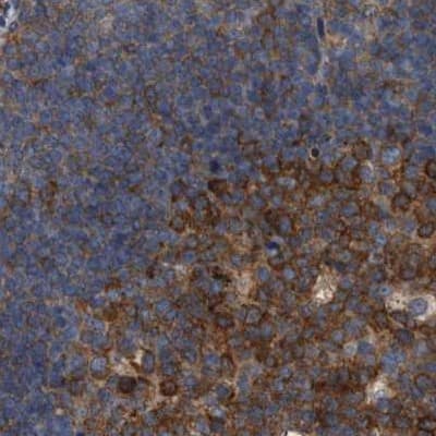 Staining of human lymph node.