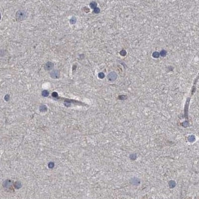 Staining of human cerebral cortex.