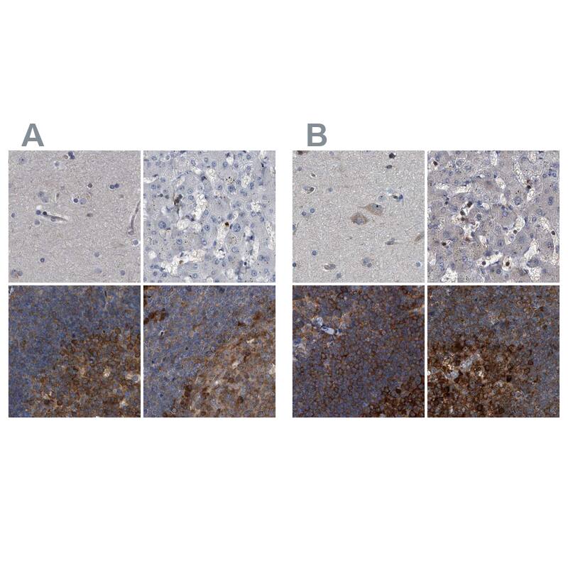 <b>Orthogonal Strategies Validation. </b>Staining of human cerebral cortex, liver, lymph node and tonsil HPA029763 (A) shows similar protein distribution across tissues to independent antibody HPA029761 (B).