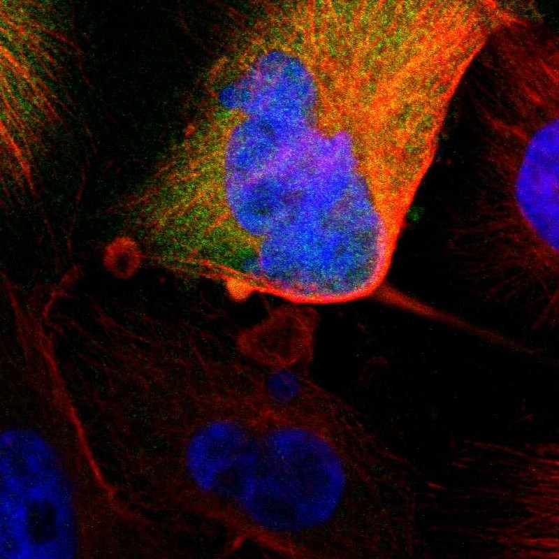 Staining of human cell line U-251 MG shows localization to cytosol.