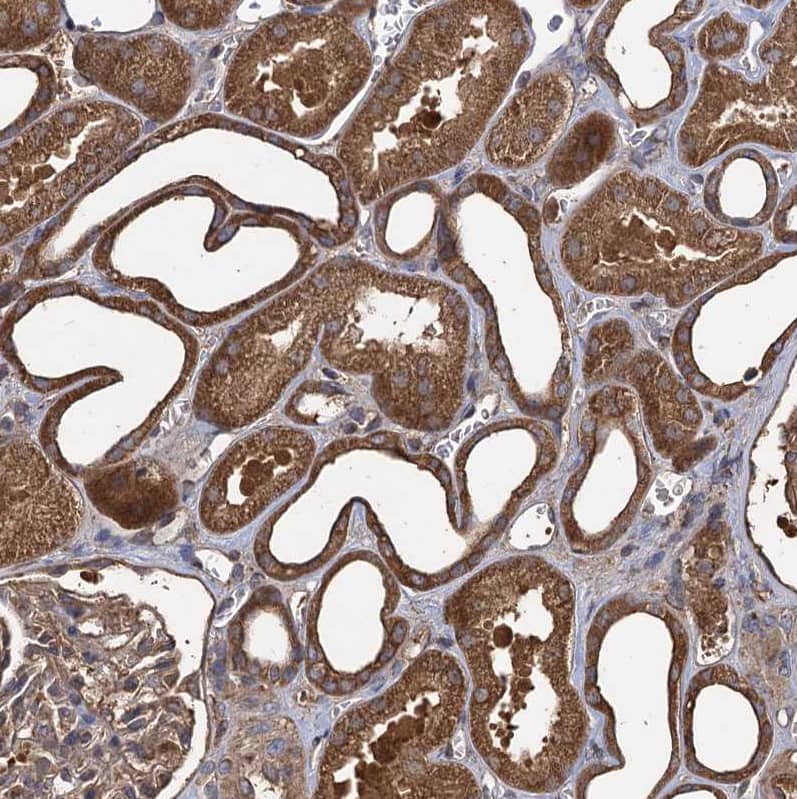 Staining of human kidney shows strong cytoplasmic positivity in cells in tubules.