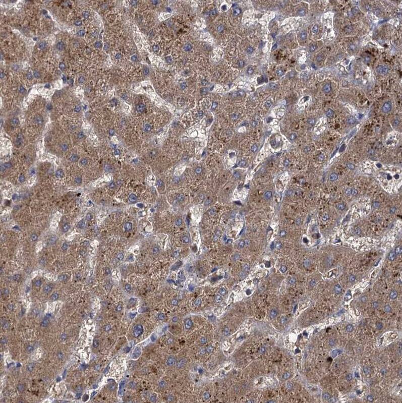 Staining of human liver shows strong cytoplasmic positivity in hepatocytes.