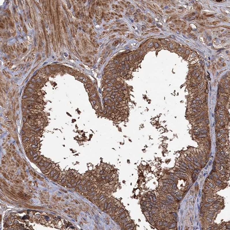 Staining of human prostate shows strong cytoplasmic positivity in glandular cells.