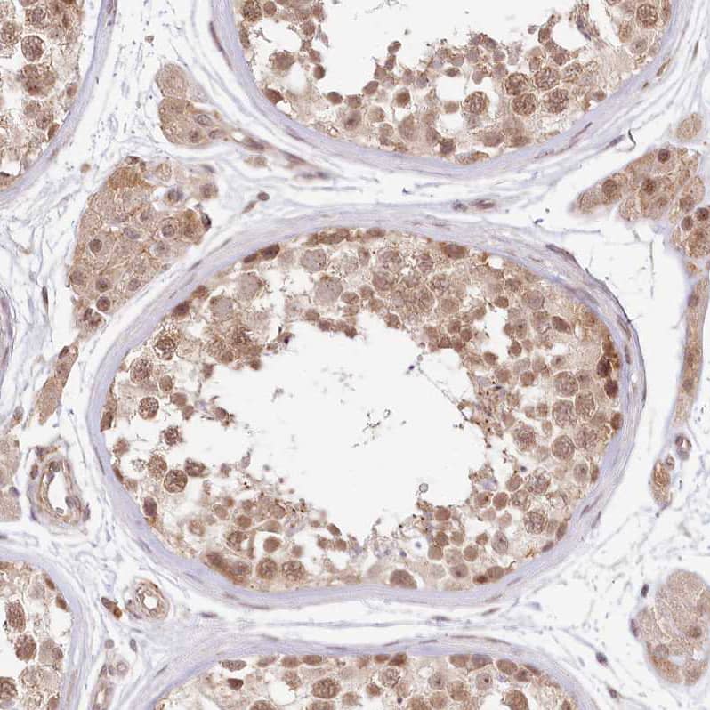Immunohistochemistry-Paraffin TUBGCP2 Antibody - BSA Free
