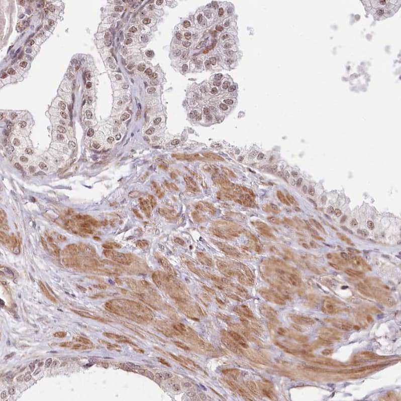Staining of human prostate shows moderate positivity in glandular and smooth muscle cells.