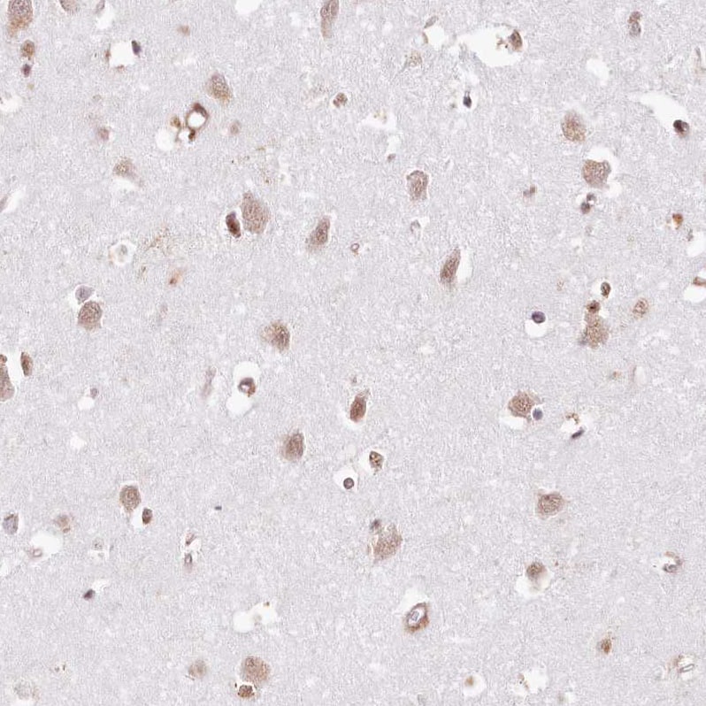 Staining of human cerebral cortex shows moderate positivity in neurons.