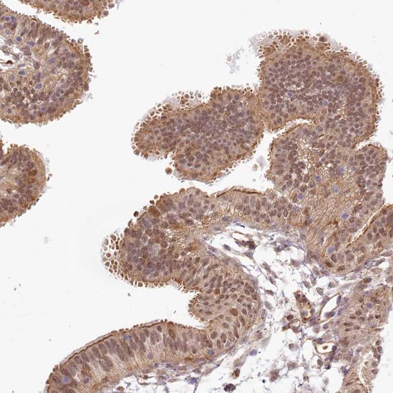 Staining of human Fallopian tube shows strong positivity in glandular cells.