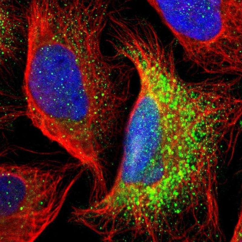 Staining of human cell line U-2 OS shows localization to vesicles.