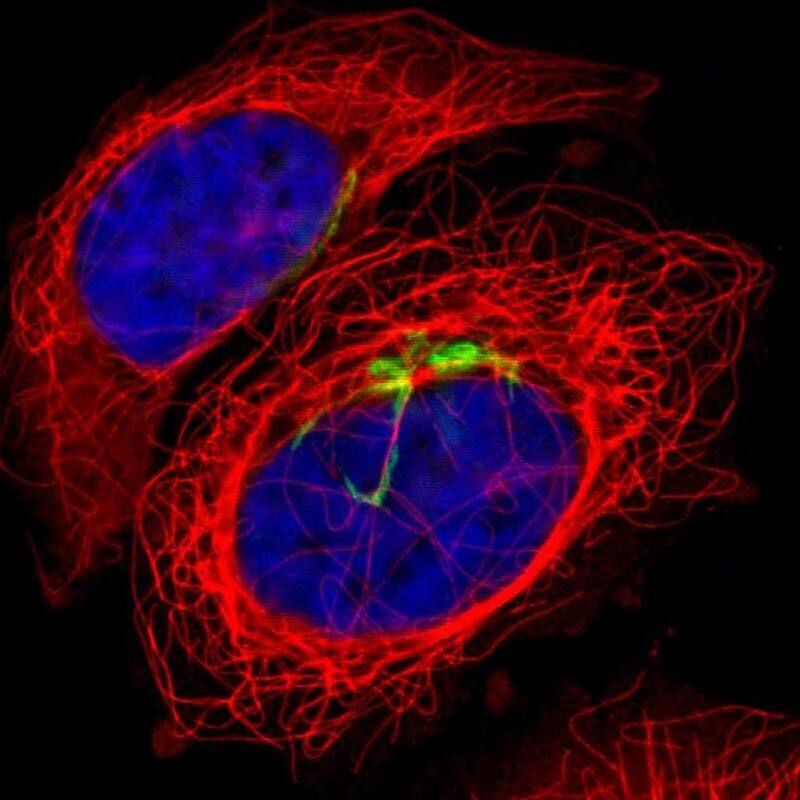 Staining of human cell line A-431 shows localization to the Golgi apparatus.