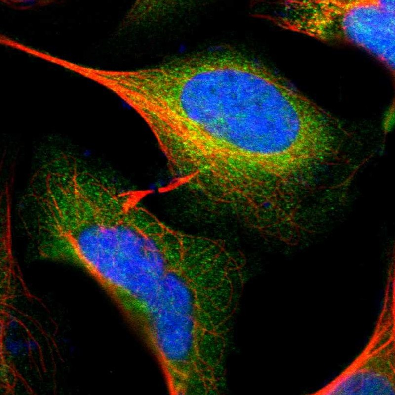 Staining of human cell line U-2 OS shows localization to cytosol.