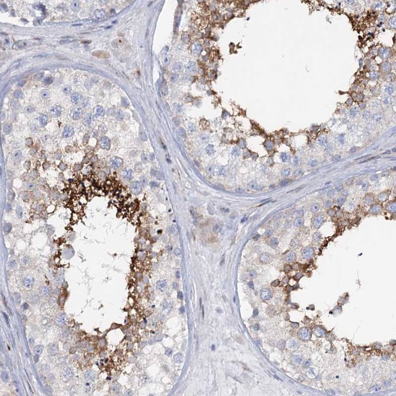 Staining of human testis shows high expression.